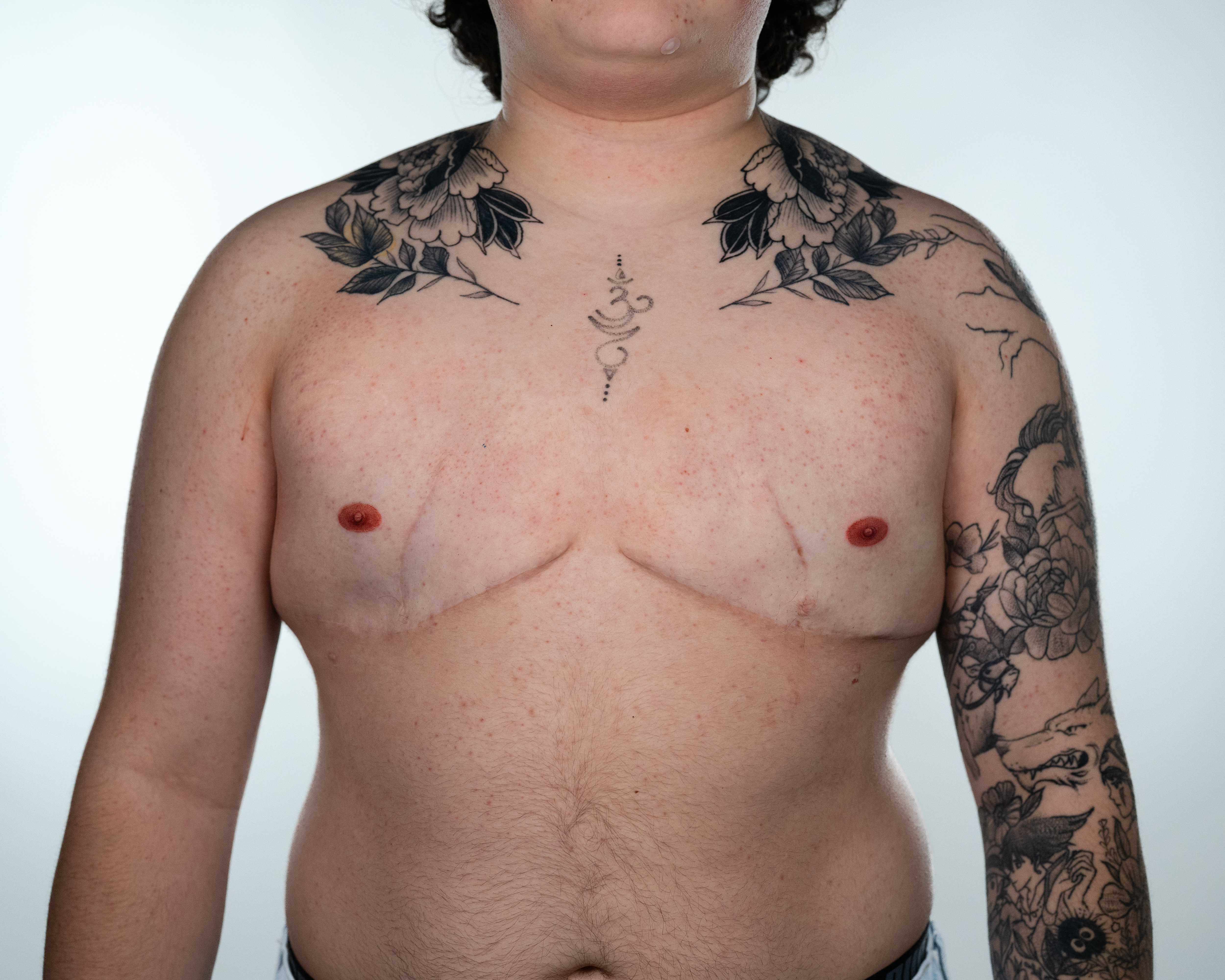 Reconstructive Nipple Tattooing gallery image 3